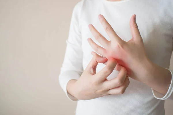 Jonge Vrouw Krabt Jeuk Aan Haar Handen Roodheid Uitslag Oorzaak — Stockfoto