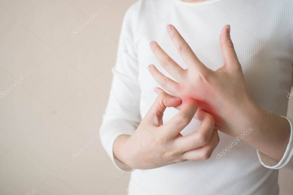 Young woman scratching the itch on her hands w/ redness rash. Cause of itchy skin include dermatitis (eczema), dry skin, burned, food/drugs allergies, insect bites. Health care concept. Copy space.