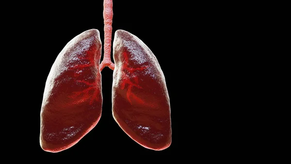 Siyah arka planda insan akciğer anatomisi, akciğer kanseri diyagramı, 3 boyutlu görüntüleme.