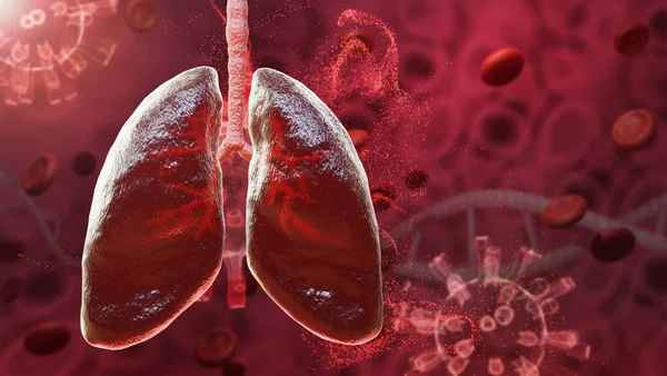 Kırmızı akciğer solunum yolu insan sararı salgını, mikrop, akciğerde sars virüsü salgını, 3D görüntüleme