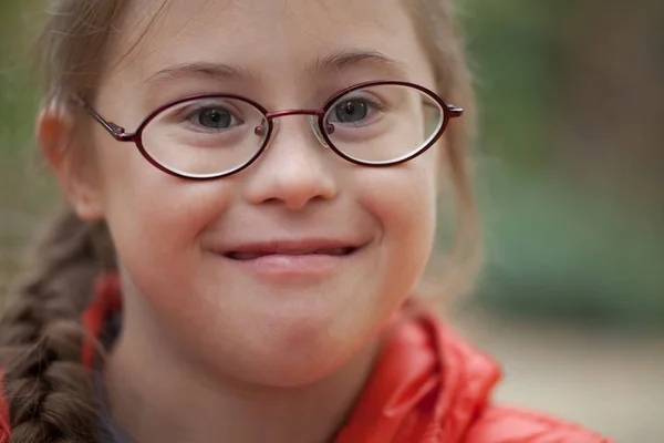 Портрет девушки с особыми потребностями в очках крупным планом — стоковое фото