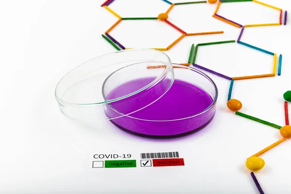 Concepto Epidémico Coronavirus Inscripción Covid Contra Modelo Molecular Química Equipo — Foto de Stock