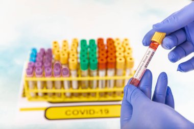 Laboratuvar çalışanı, Corona virüsü ve antikorların tespiti için test kanı hazırlıyor. SARS-CoV-2 veya COVID-19 virüs testi için kan örneği içeren test tüpü