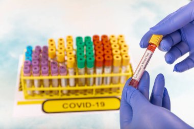 Laboratuvar çalışanı, Corona virüsü ve antikorların tespiti için test kanı hazırlıyor. SARS-CoV-2 veya COVID-19 virüs testi için kan örneği içeren test tüpü