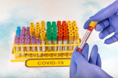 Laboratuvar çalışanı, Corona virüsü ve antikorların tespiti için test kanı hazırlıyor. SARS-CoV-2 veya COVID-19 virüs testi için kan örneği içeren test tüpü
