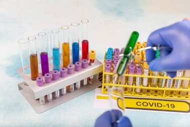 Laboratuvar çalışanı, Corona virüsü ve antikorların tespiti için test kanı hazırlıyor. SARS-CoV-2 veya COVID-19 virüs testi için kan örneği içeren test tüpü