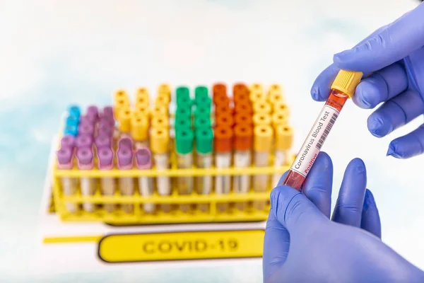 Trabajador Laboratorio Preparando Sangre Prueba Para Detección Anticuerpos Infecciones Por —  Fotos de Stock