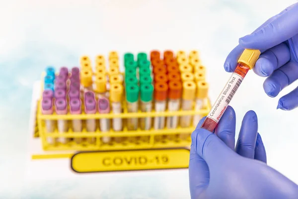 Lab worker preparing test blood for detection of antibodies and infections Corona virus.  Test tube with blood sample for SARS-CoV-2 or COVID-19 virus test