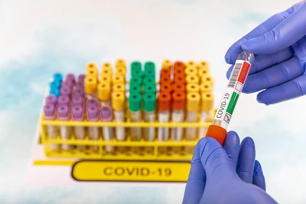 Lab worker preparing test blood for detection of antibodies and infections Corona virus.  Test tube with blood sample for SARS-CoV-2 or COVID-19 virus test