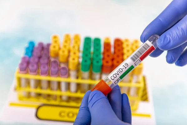 Lab worker preparing test blood for detection of antibodies and infections Corona virus.  Test tube with blood sample for SARS-CoV-2 or COVID-19 virus test