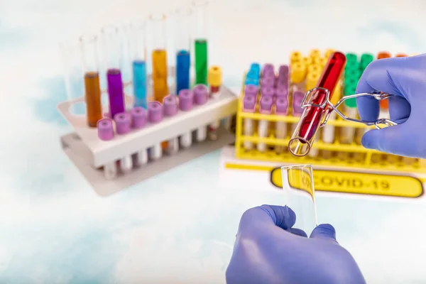 Lab worker preparing test blood for detection of antibodies and infections Corona virus.  Test tube with blood sample for SARS-CoV-2 or COVID-19 virus test