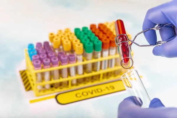 Trabajador Laboratorio Preparando Sangre Prueba Para Detección Anticuerpos Infecciones Por —  Fotos de Stock