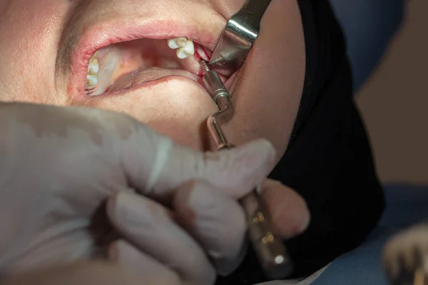 Dentist Dental Braces Clinic — Φωτογραφία Αρχείου