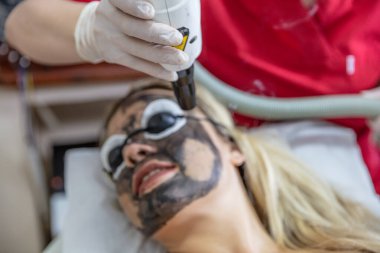 Carbon face peeling procedure. Laser pulses clean skin of the face. Hardware cosmetology treatment. Process of photothermolysis, warming the skin, laser carbon peeling. Facial skin rejuvenation. clipart