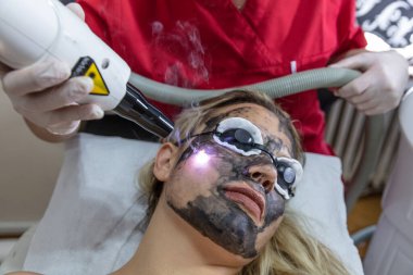 The cosmetologist applies the carbon nanogel to the skin of the client's face. Preparation for laser treatment of the skin. Carbon face peeling. clipart