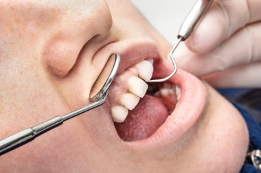 dentist examining teeth with dental braces