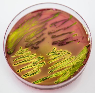 Eosin Metilen Mavi Aar (EMB) üzerinde Escherichia coli 'nin metalik yeşil parıltısı karakteristik kolonileri.