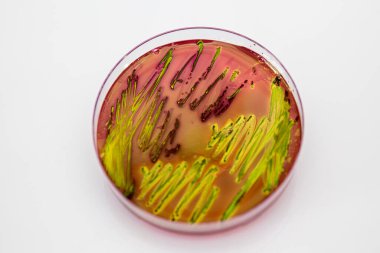Eosin Metilen Mavi Aar (EMB) üzerinde Escherichia coli 'nin metalik yeşil parıltısı karakteristik kolonileri.
