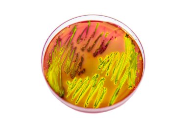 Eosin Metilen Mavi Aar (EMB) üzerinde Escherichia coli 'nin metalik yeşil parıltısı karakteristik kolonileri.