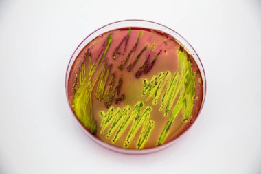 Eosin Metilen Mavi Aar (EMB) üzerinde Escherichia coli 'nin metalik yeşil parıltısı karakteristik kolonileri.