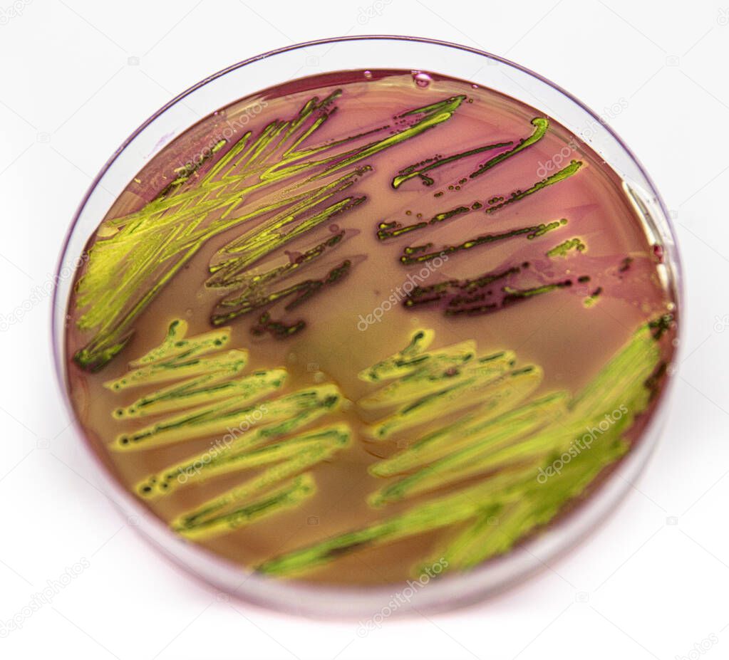 Metallic green sheen characteristic colonies of Escherichia coli on Eosin Methylene Blue Aar (EMB) in close up.