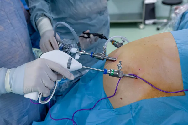 Bariatrik cerrah obeziteyi, yakın çekim ve cerrahi aletleri tedavi etmek için gastrik kol prosedürü uyguluyor..