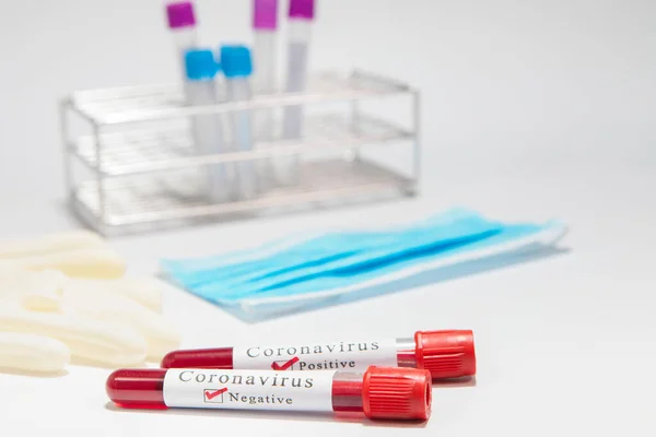 Kan örneğiyle Coronavirus test tüpü