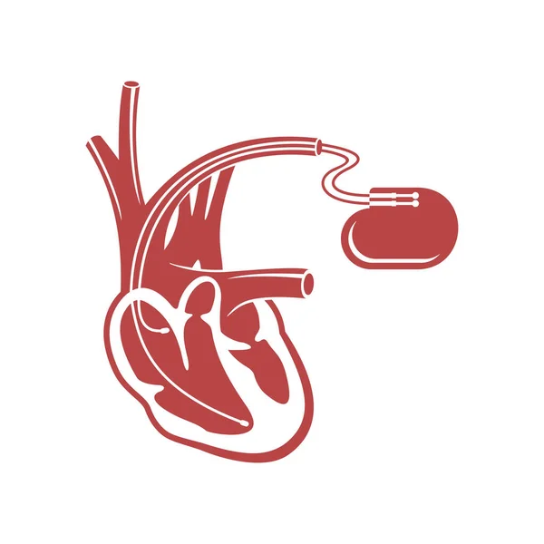 Pacemaker cardiostimulator platte icoon — Stockvector