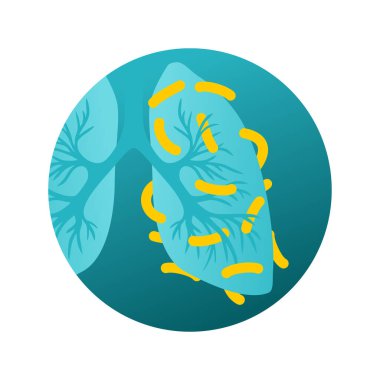 Tüberküloz hastalığı - bakterilerin sebep olduğu akciğerler 