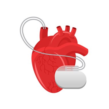 Kalp pili - insan kalbi ve kalp implantı 