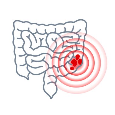 Colon cancer icon -  intestine and pain circles clipart