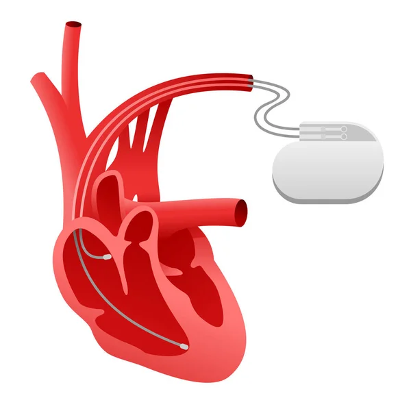 Kalp pili canlandırıcı simgesi — Stok Vektör