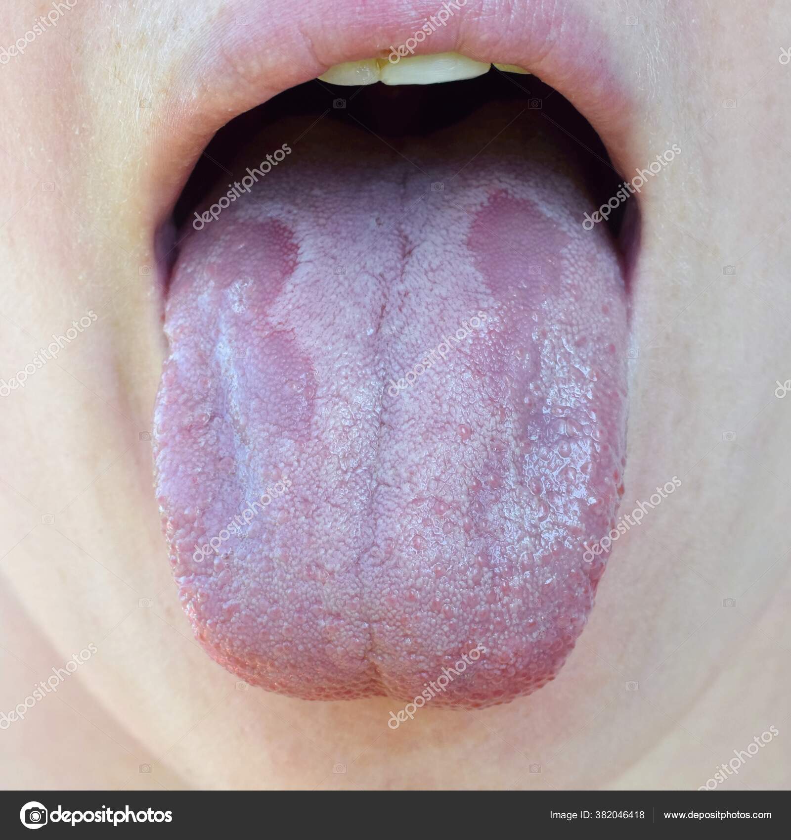 Tungi klublardan yalangoch fotosuratlar Tungi klublardan yalangoch fotosuratlar