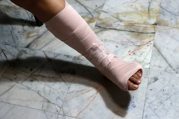 Left legs and feet be in plaster cast because splintered, splint is a strip of rigid material used for supporting and immobilizing a broken bone when it has been set.