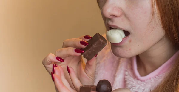 Young woman with acne problem eating chocolate bar and sweets . Skin allergy. Concept of skin problems