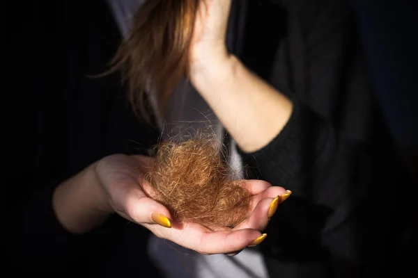 Woman Loss Hair Concept Baldness Problems — Stock Photo, Image