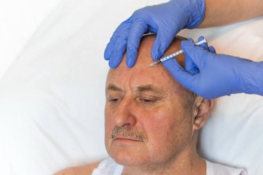Yaşlı bir adamın doğal görünüşü kozmetik enjeksiyon yaptırır. Doktorların elleri yüzünden iğne yapıyor. Güzellik Tedavisi
