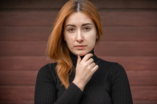 Acne Scars Simple Woman Close Natural Portrait Makeup Retouch Problem — Stock Photo, Image