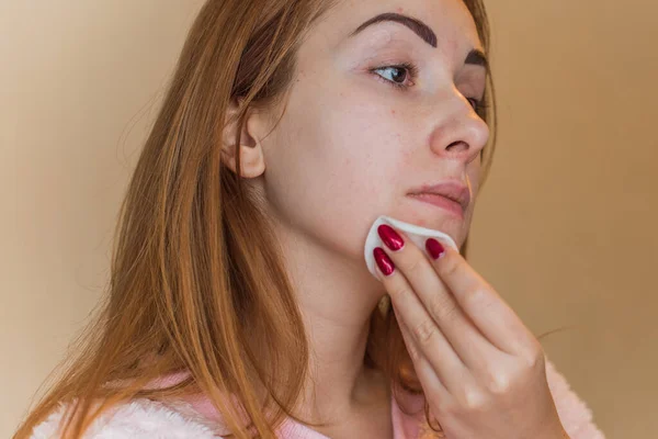 Acné Cicatrices Mujer Sencilla Cerca Retrato Natural Sin Maquillaje Retoque — Foto de Stock