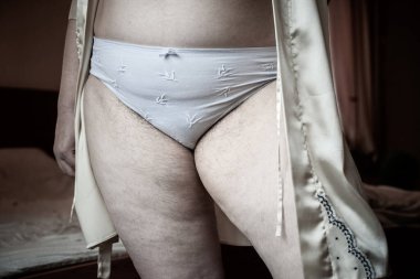 Hormonal bozukluk, kıllı vücut, kadınlarda aşırı ağırlık. Sağlık sorunları, artan kilolu konsept