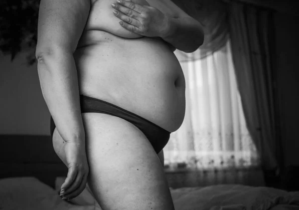 荷尔蒙紊乱 毛茸茸的身体 超重的女人 健康问题 增加发质超重的概念 — 图库照片