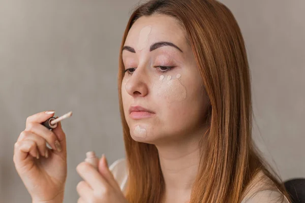 Acne Post Acne Skin Scars Skin Care Concept Beauty Girl — Stock Photo, Image