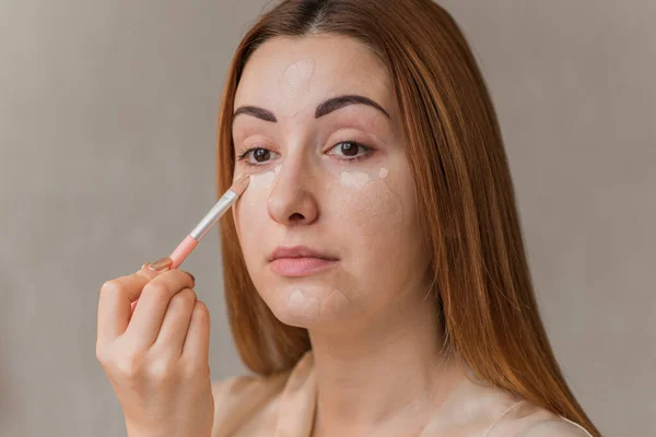 Acne Post Acne Skin Scars Skin Care Concept Beauty Girl — Stock Photo, Image