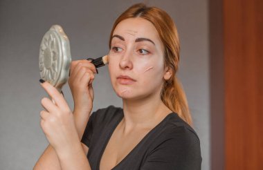 Sivilce, sivilce, yara izi, cilt bakımı. Güzellik anlayışı, kız sorunlu bir cilde makyaj yapar.