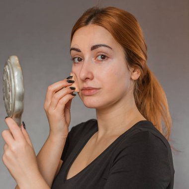 Sivilce, sivilce, yara izi, cilt bakımı. Güzellik anlayışı, kız sorunlu bir cilde makyaj yapar.