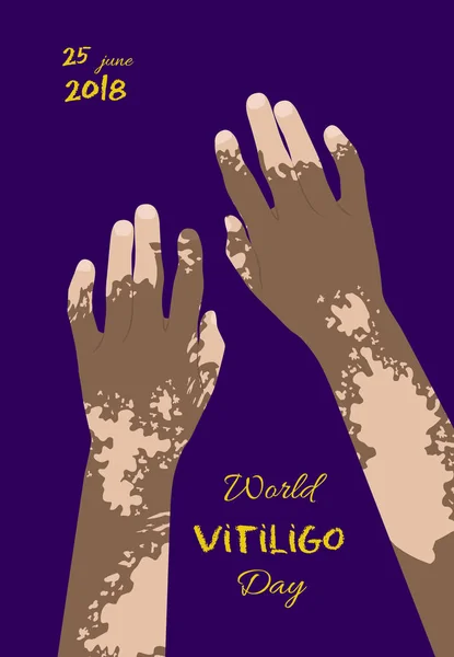 Wereld Vitiligo dag poster — Stockvector