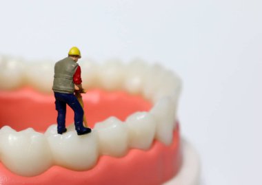 Diş modelinin üstünde duran minyatür bir adam..