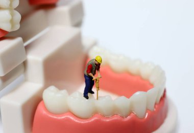 Diş modelinin üstünde duran minyatür bir adam..
