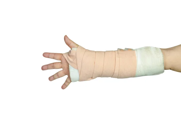手工操作治疗在白色背景下隔离的意外骨折腕部 切断路径 — 图库照片