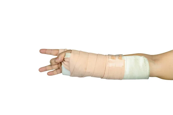 手工操作治疗在白色背景下隔离的意外骨折腕部 切断路径 — 图库照片